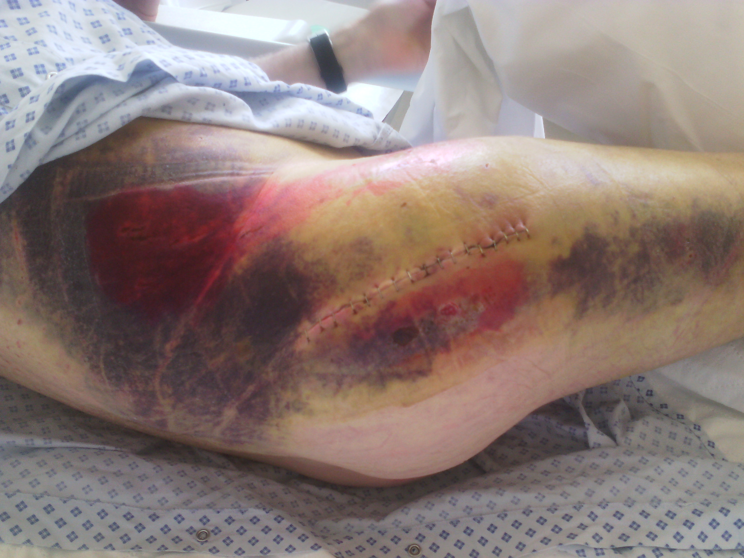 Warning This is gross Forums