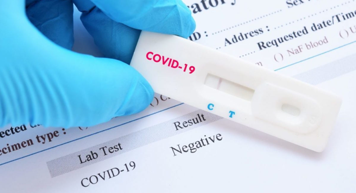COVID19 Inhouse Testing Vanité Clinic Solihull