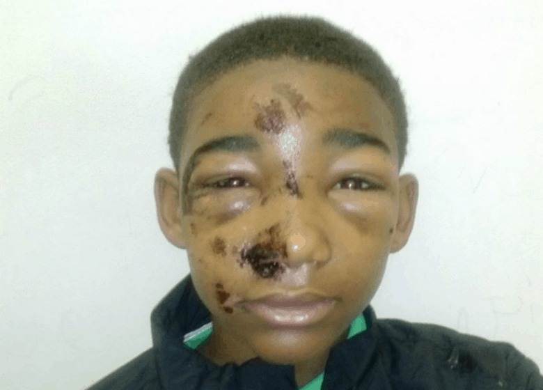 Editorial 14 Year Old Black Pa Teen Another Victim Of Police