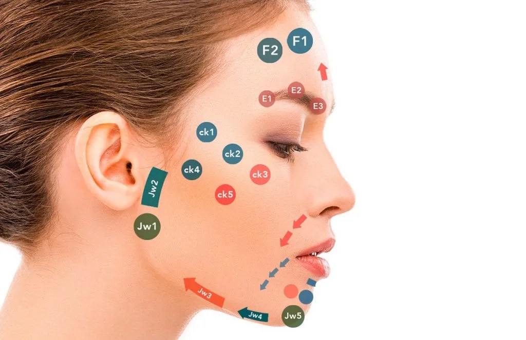 A filler treatment using MD Codes™ Van Rosmalen Kliniek