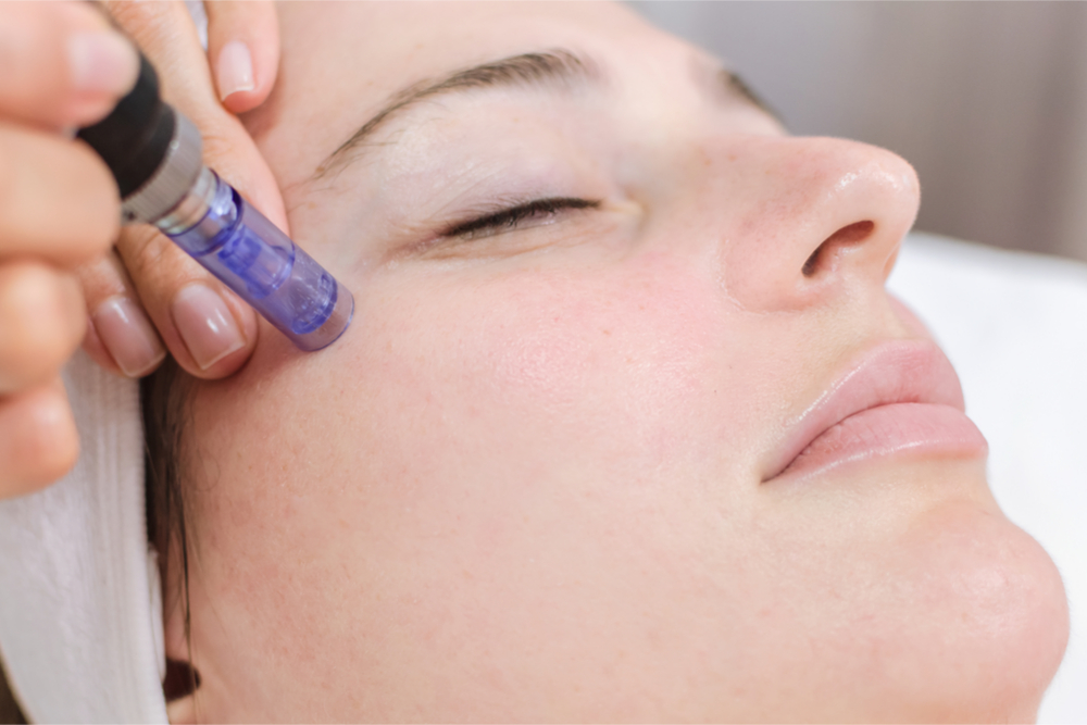 Find out the causes of uneven skin tone and what you can do to treat and prevent hyperpigmentation to help gradually reduce the look of uneven skin tone. Repairing Skin Damage With The Micropen Treatment Vargas Face And Skin Center
