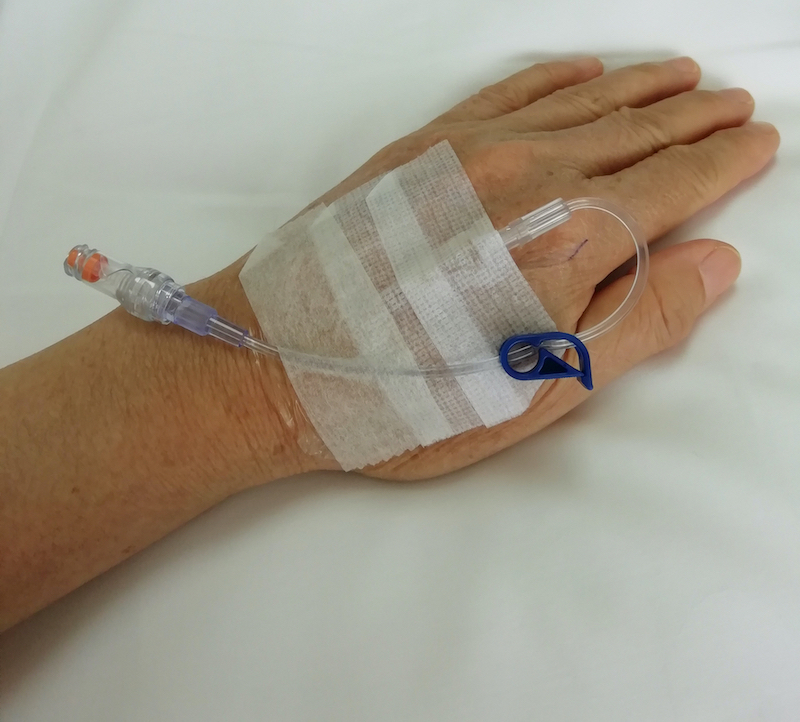 Peripheral IVs and PIVs Vascular Wellness