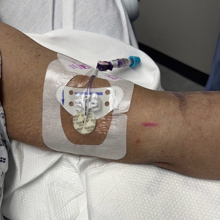 Midline Catheter Dressing Change Kit at Rosalina Lazzaro blog