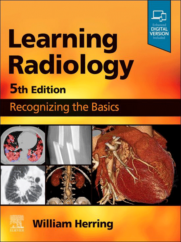 Learning Radiology Recognizing the Basics, 5th Edition Vasiliadis