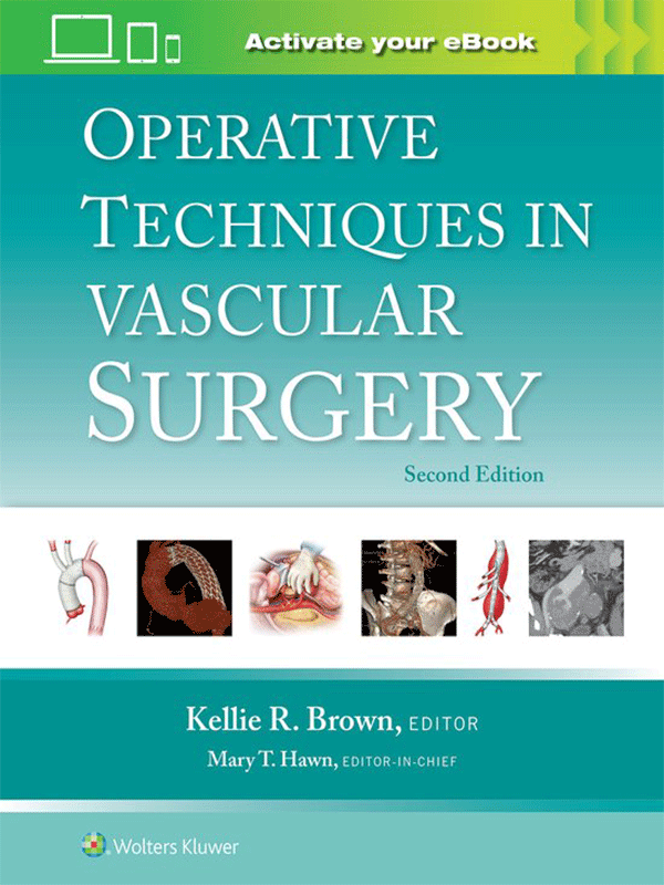 Operative Techniques in Vascular Surgery, 2nd Edition Vasiliadis