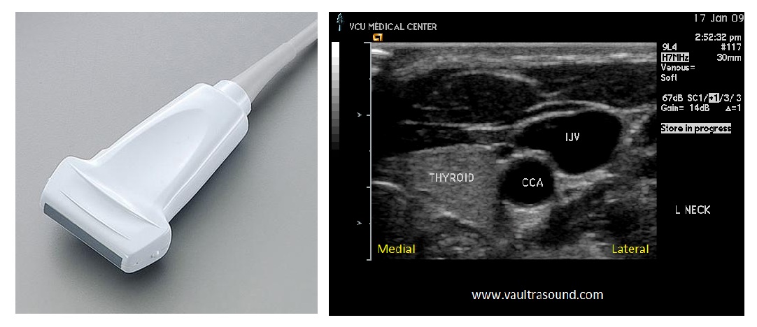 Transducer Selection « VAULT
