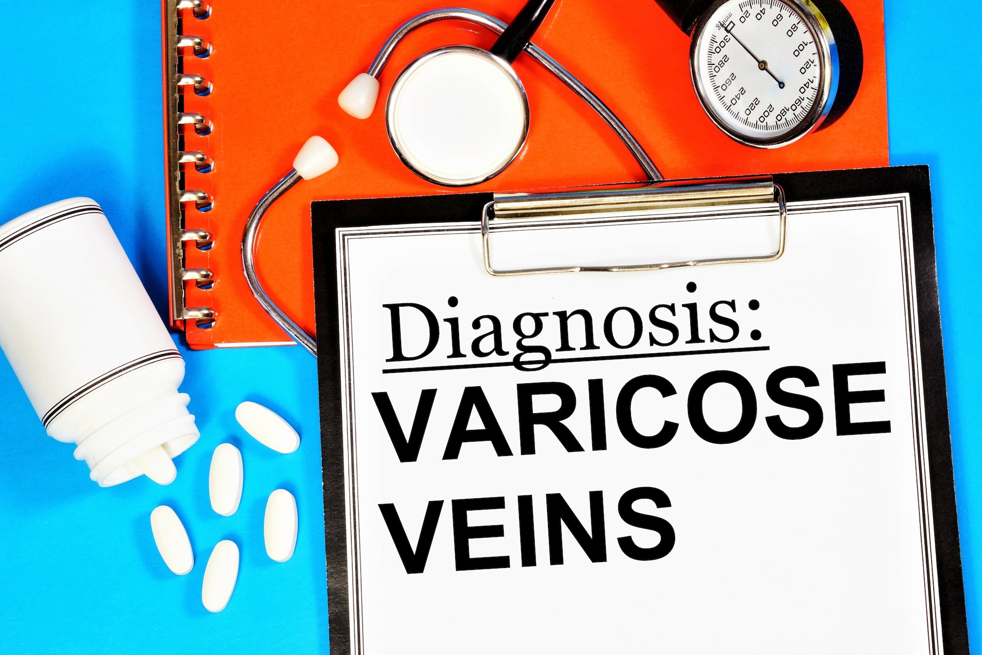 Do Varicose Veins Qualify for Insurance Coverage