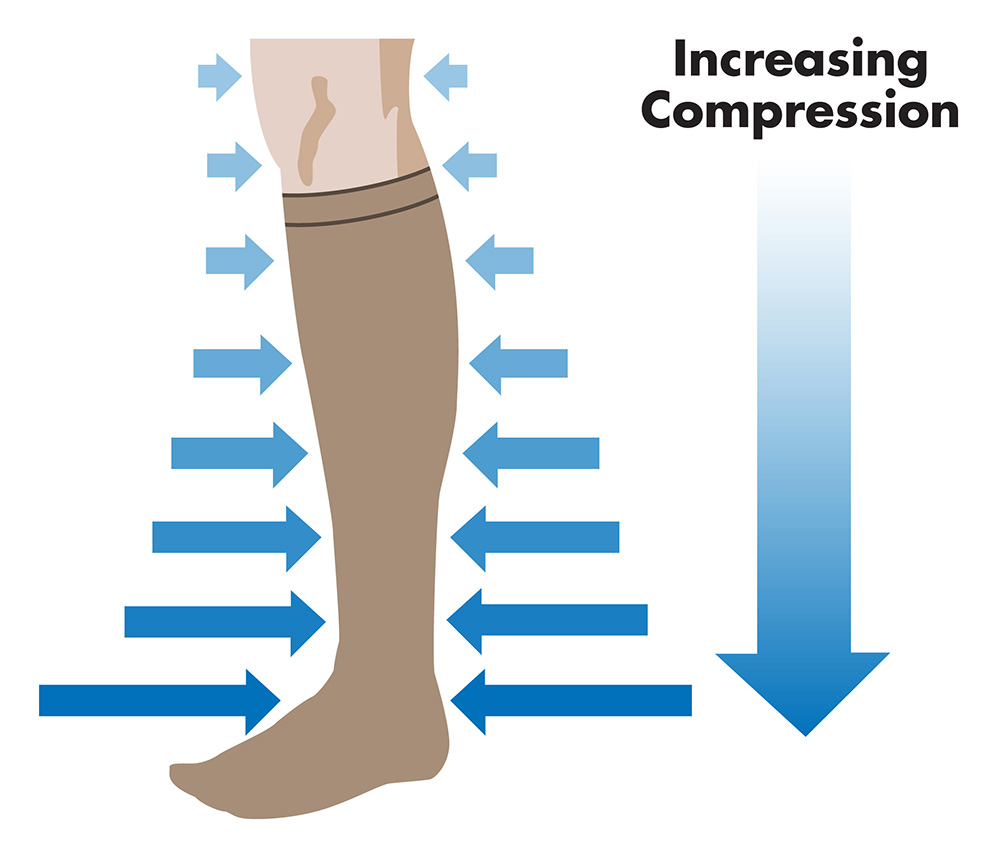 Compression Socks for Varicose Veins Vein Specialists of the South