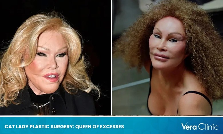 The Cat Woman Plastic Surgery