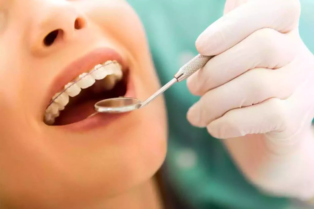 Case 22 Ruslana Rodina Vera Smile