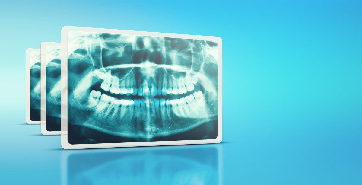 IRMER Annual Refresher Verified Learning