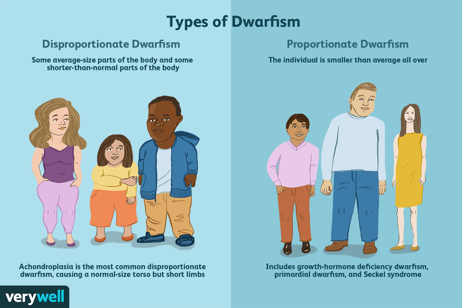 Most Common Types of Dwarfism