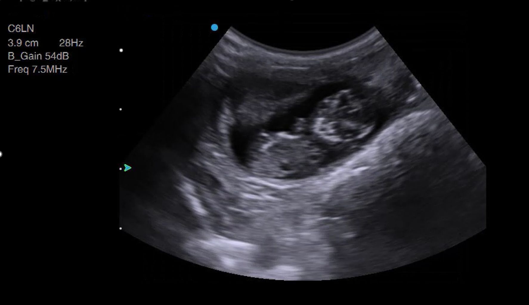 Small animal pregnancy scanning using ultrasound introducing key