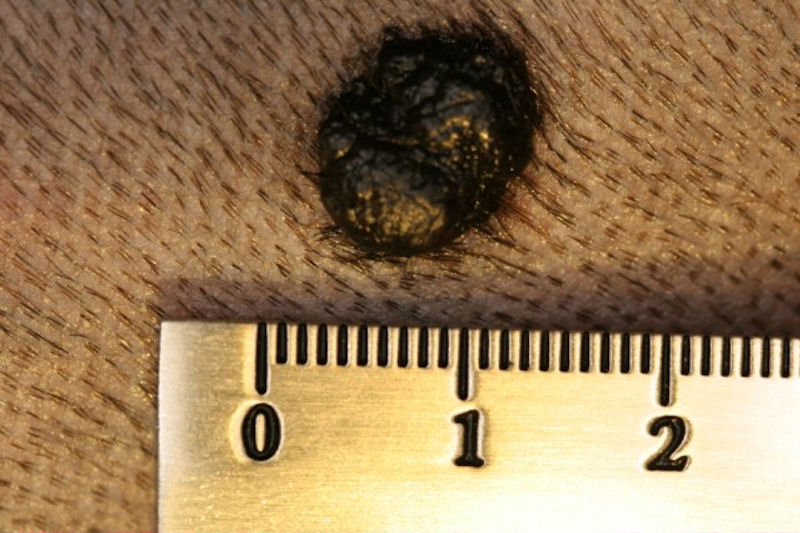 Skin melanoma in Dogs (Canis) Vetlexicon