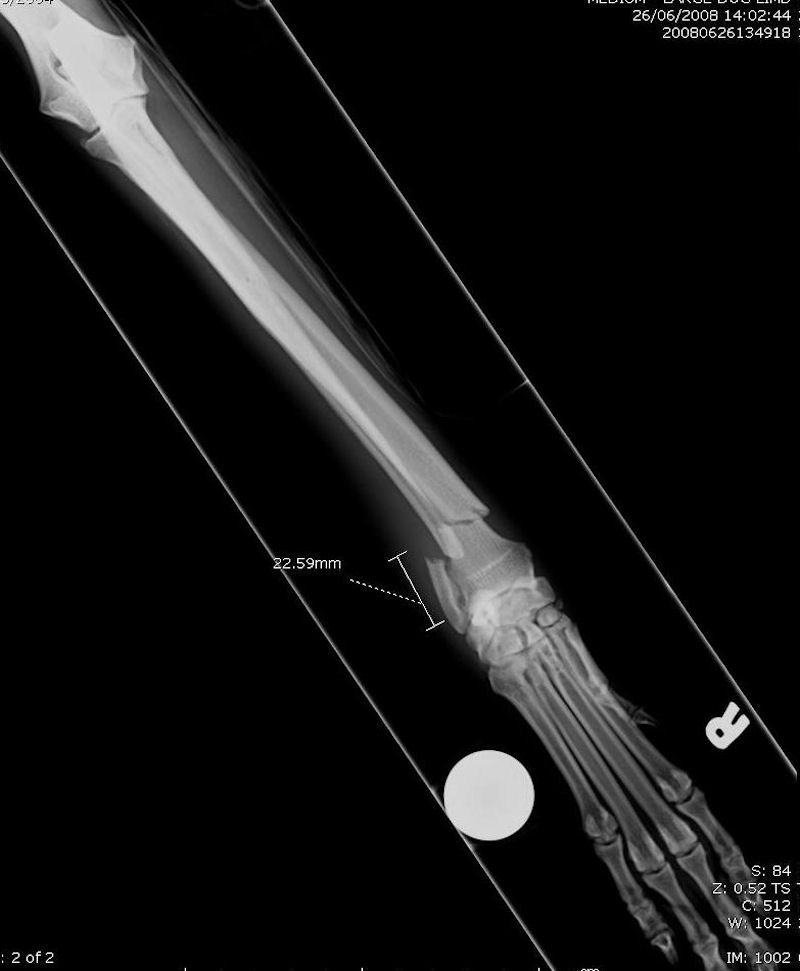 Radius ulna fracture (preoperative) 02 radiograph CrCd in Dogs