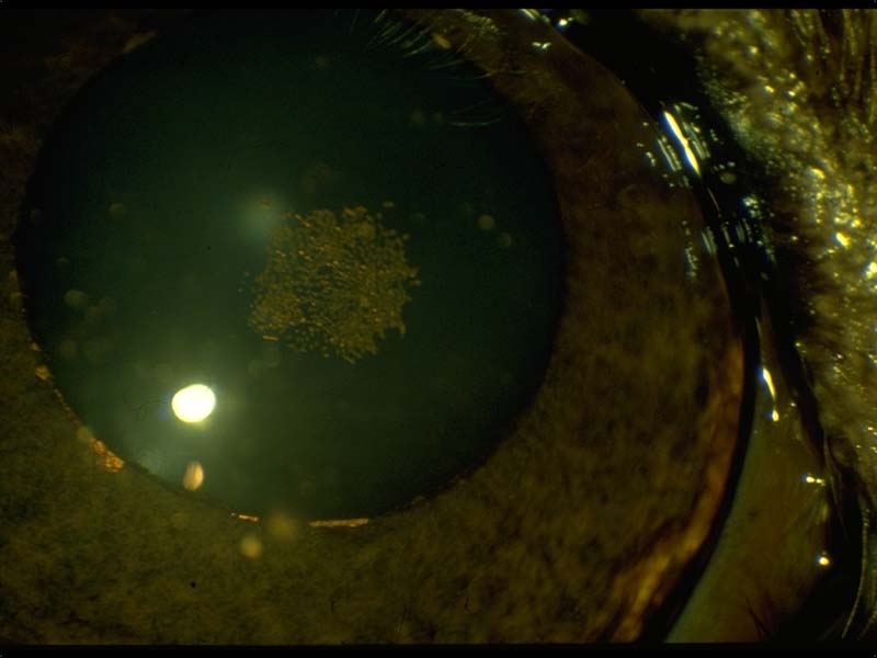 Pigment on anterior lens capsule Cocker Spaniel 5 years golden in Dogs (Canis) Vetlexicon