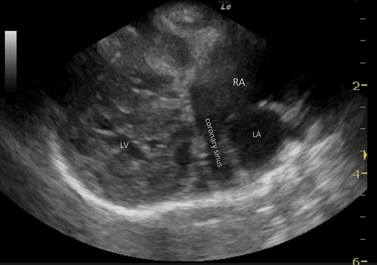 persistent left cranial vena cava Vet Practice Support