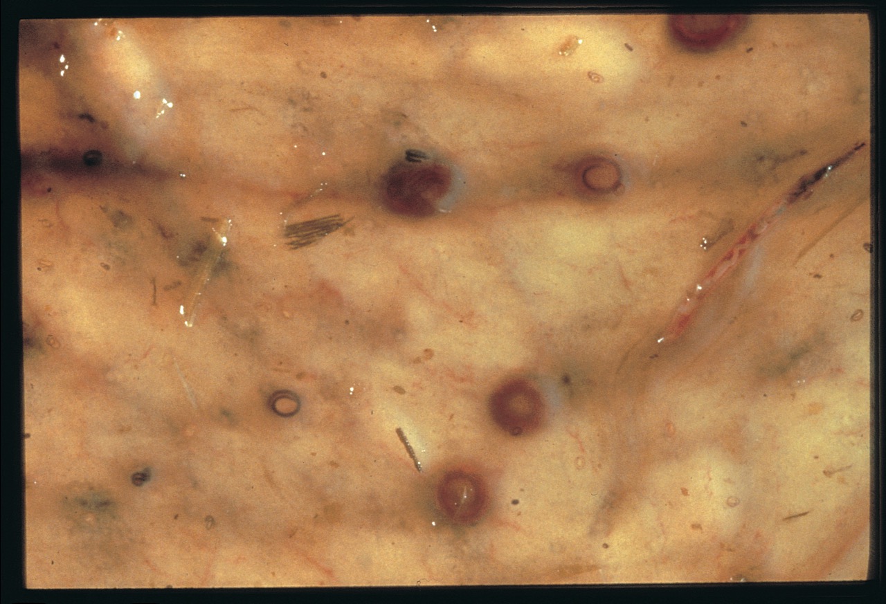 Don’t let your clients ignore Encysted Small Redworm says Zoetis