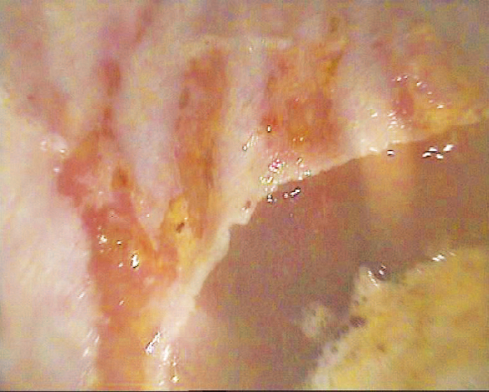 Gastric ulceration importance of management practices in equines Vet