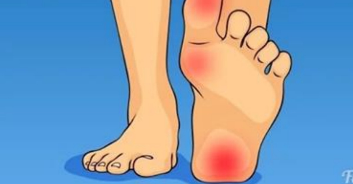 11 Motivos De Por Qué Te Duelen Los Pies ¡Descubre La Razón Aquí! Via