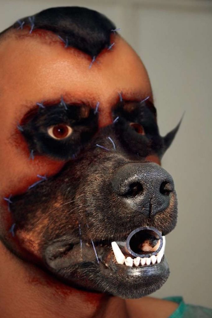 Mitad Humano, Mitad Perro. Conoce Al Hombre Que Se Transplantó La Cara