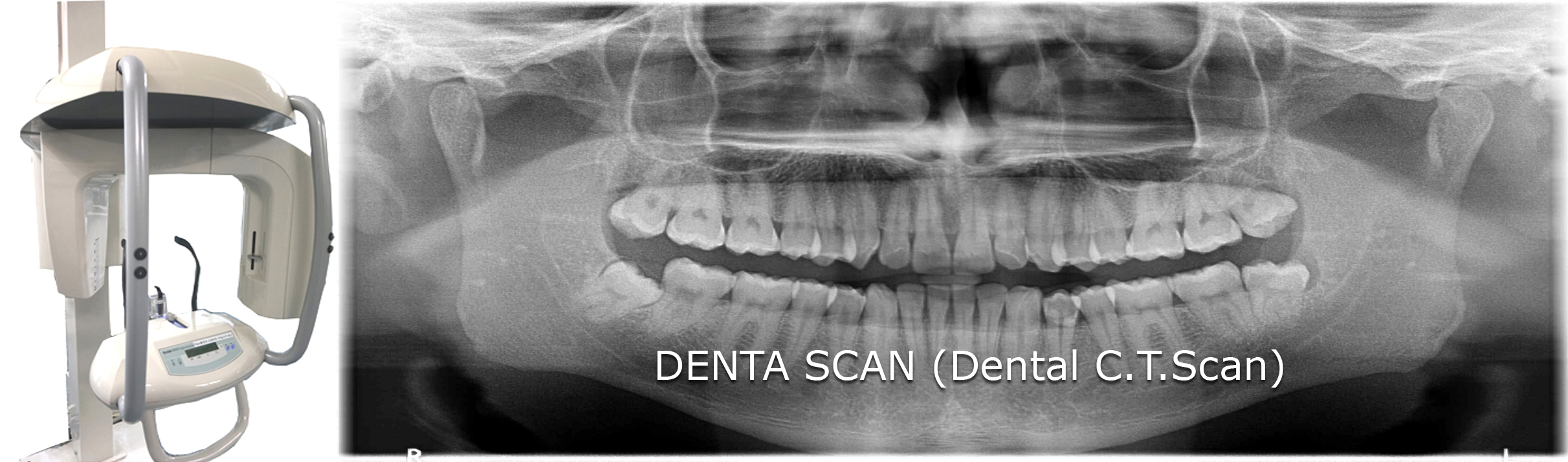 DENTA SCAN (Dental C.T.Scan) Vikas Diagnostics