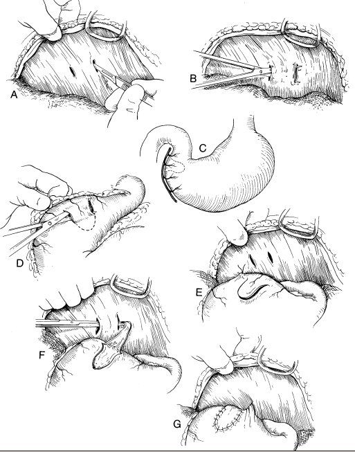 ACVC 2001 Surgical Treatment of Gastric DilatationVolvulus (GDV)