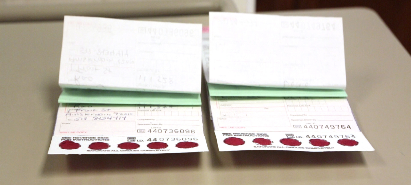 Newborn Screening Specimen Collection New York State Department of