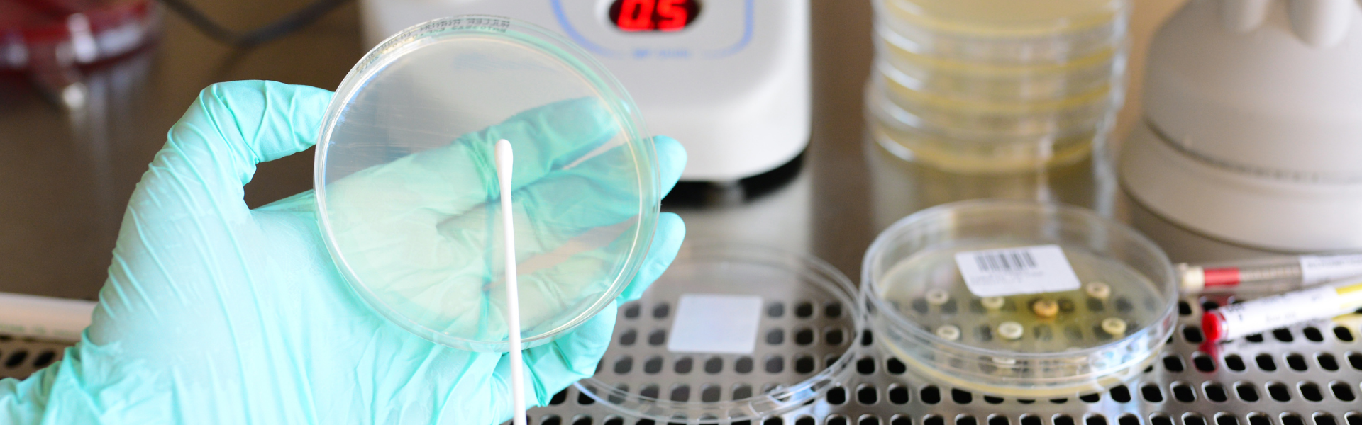 Comparing the LAL Method with the Pyrogen Test on Rabbits