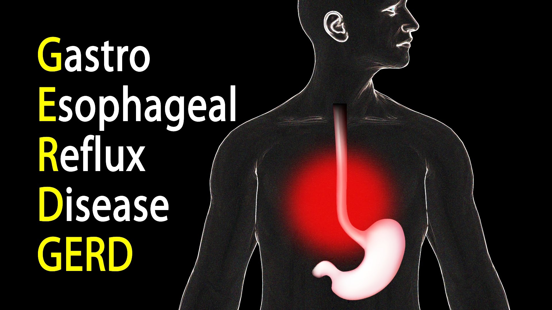 Is That Heartburn Bugging You? Here’s How You Get It Under Control