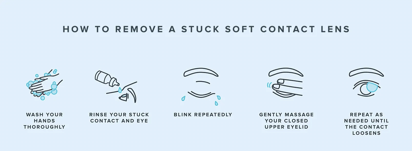 How to Remove a Contact Lens Stuck in Your Eye Warby Parker
