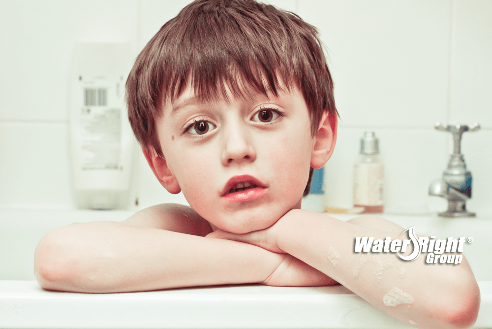 What's the Connection of Eczema & Hard Water? WaterRight
