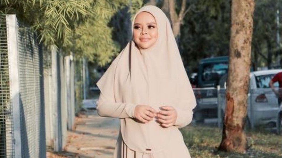 Popular Malaysian singer gets COVID19 whilst pregnant