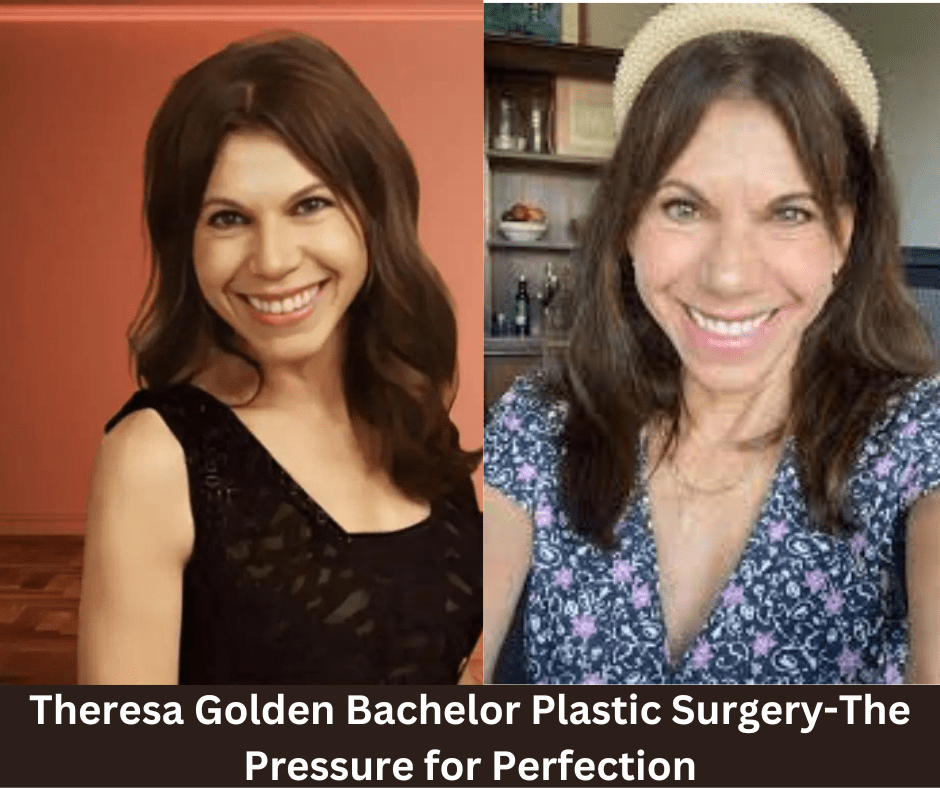 Theresa Golden Bachelor Plastic SurgeryThe Pressure for Perfection