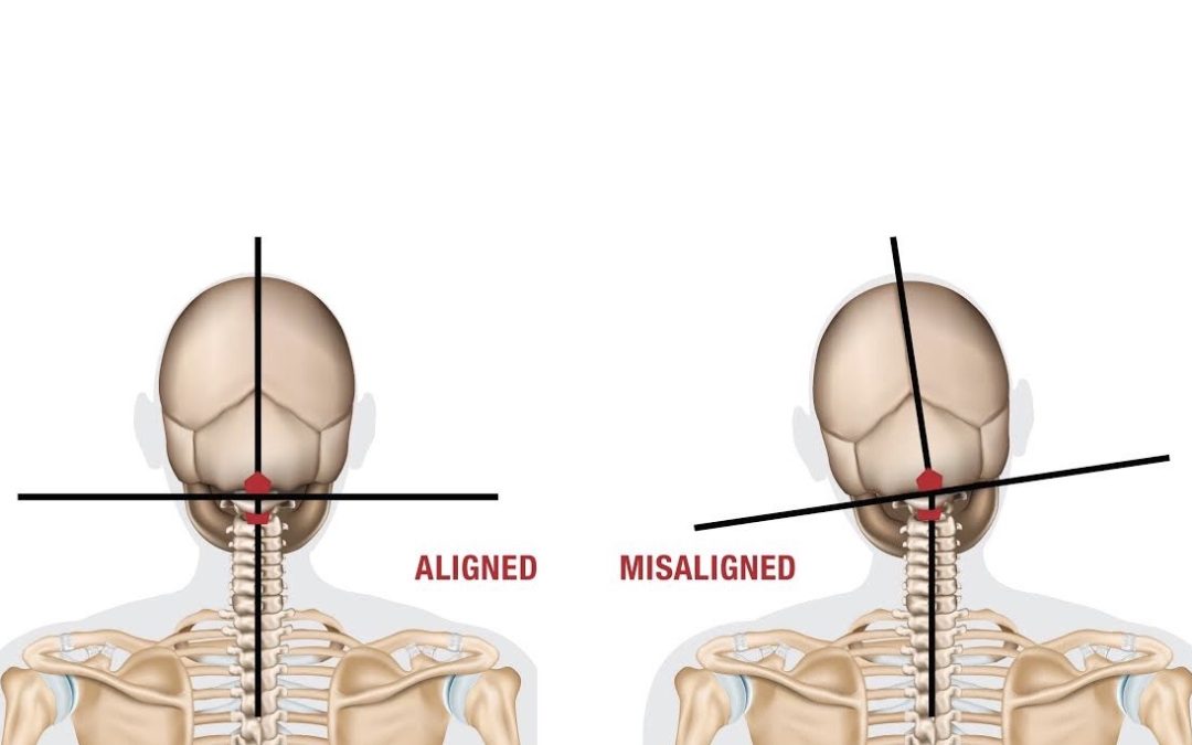 96 How Does A NUCCA Adjustment Work? Gardner Schofield Chiropractic