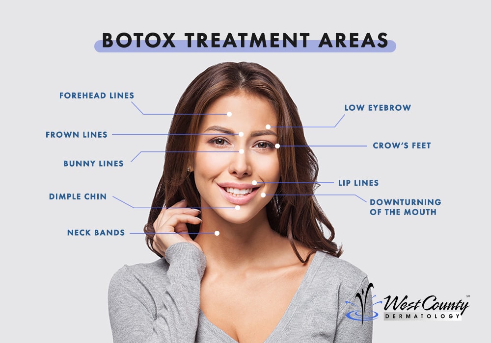 BOTOX Chesterfield, MO West County Dermatology