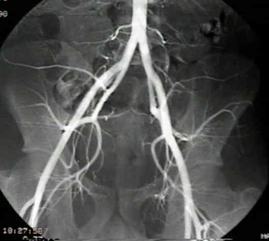 Femoral Artery : Wheeless' Textbook Of Orthopaedics