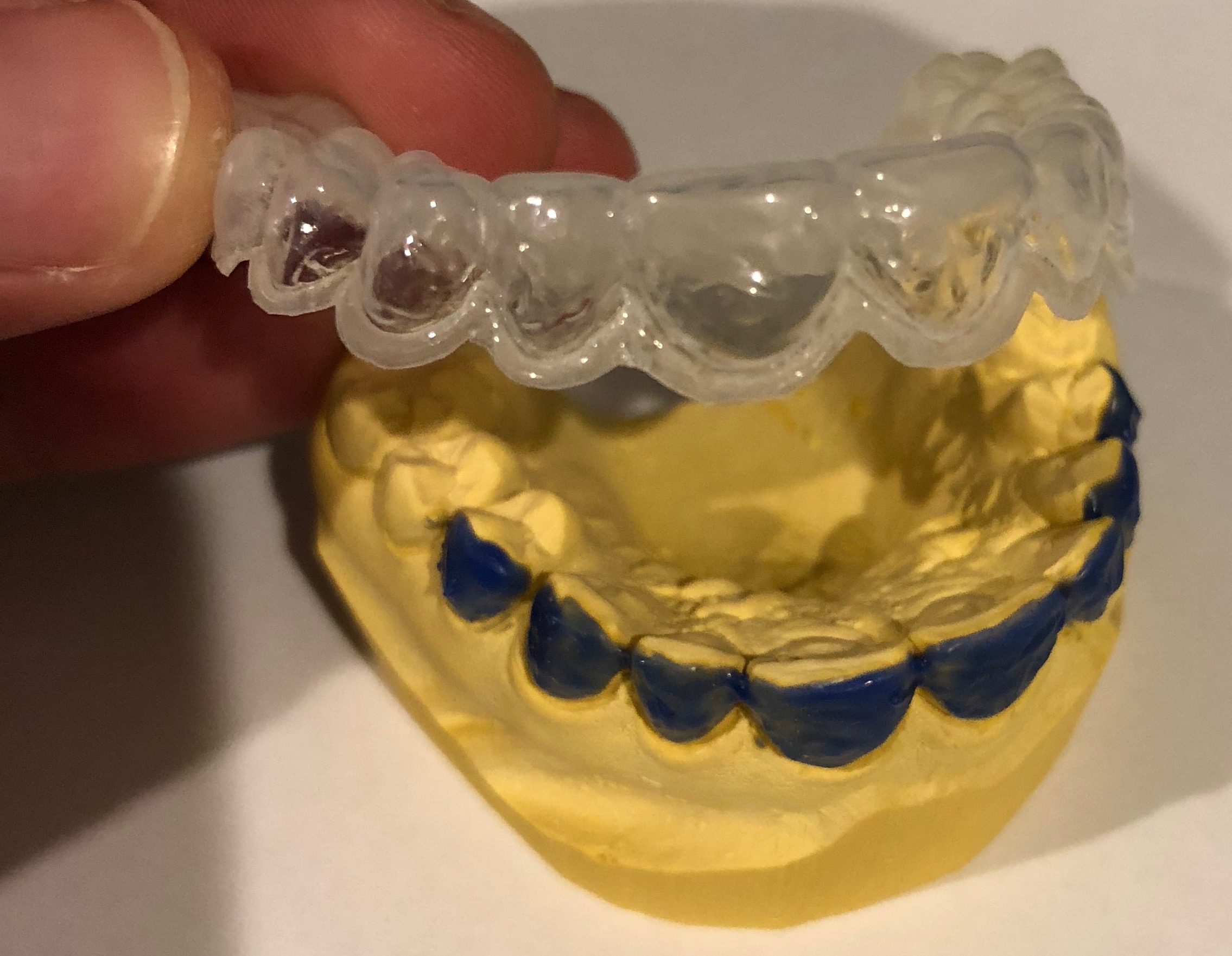 How to Make a Whitening Tray