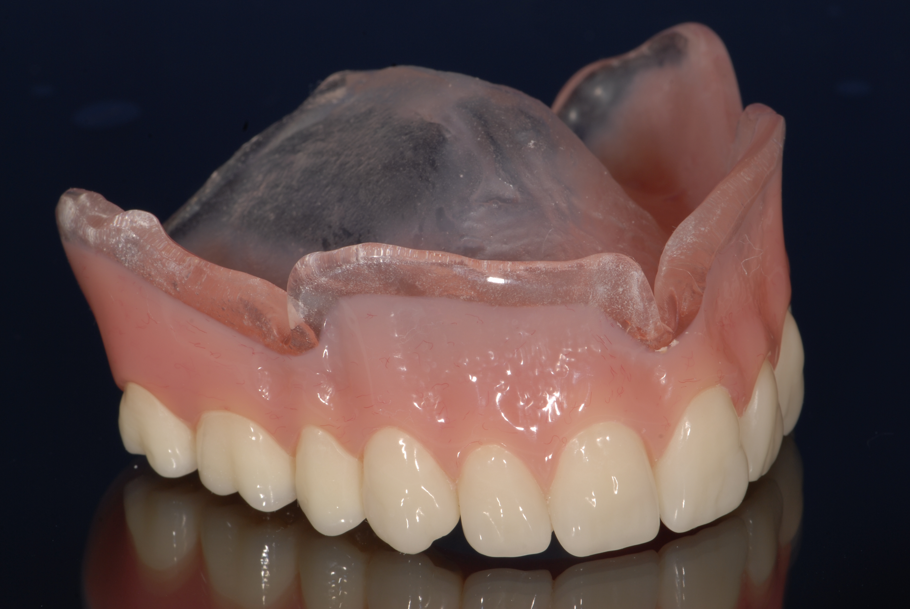 Dental Labs for Dentures in Arizona Conventional Full and Partial