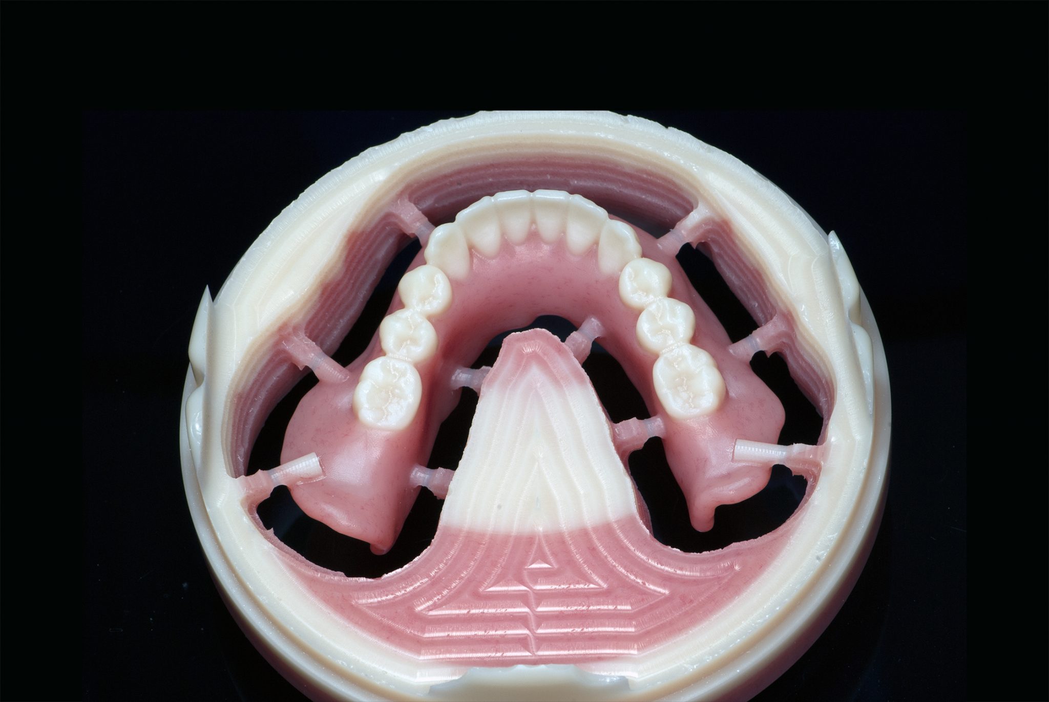 Ivoclar Ivotion Milled Digital Denture (PM7 Mill) Digital Denture Lab