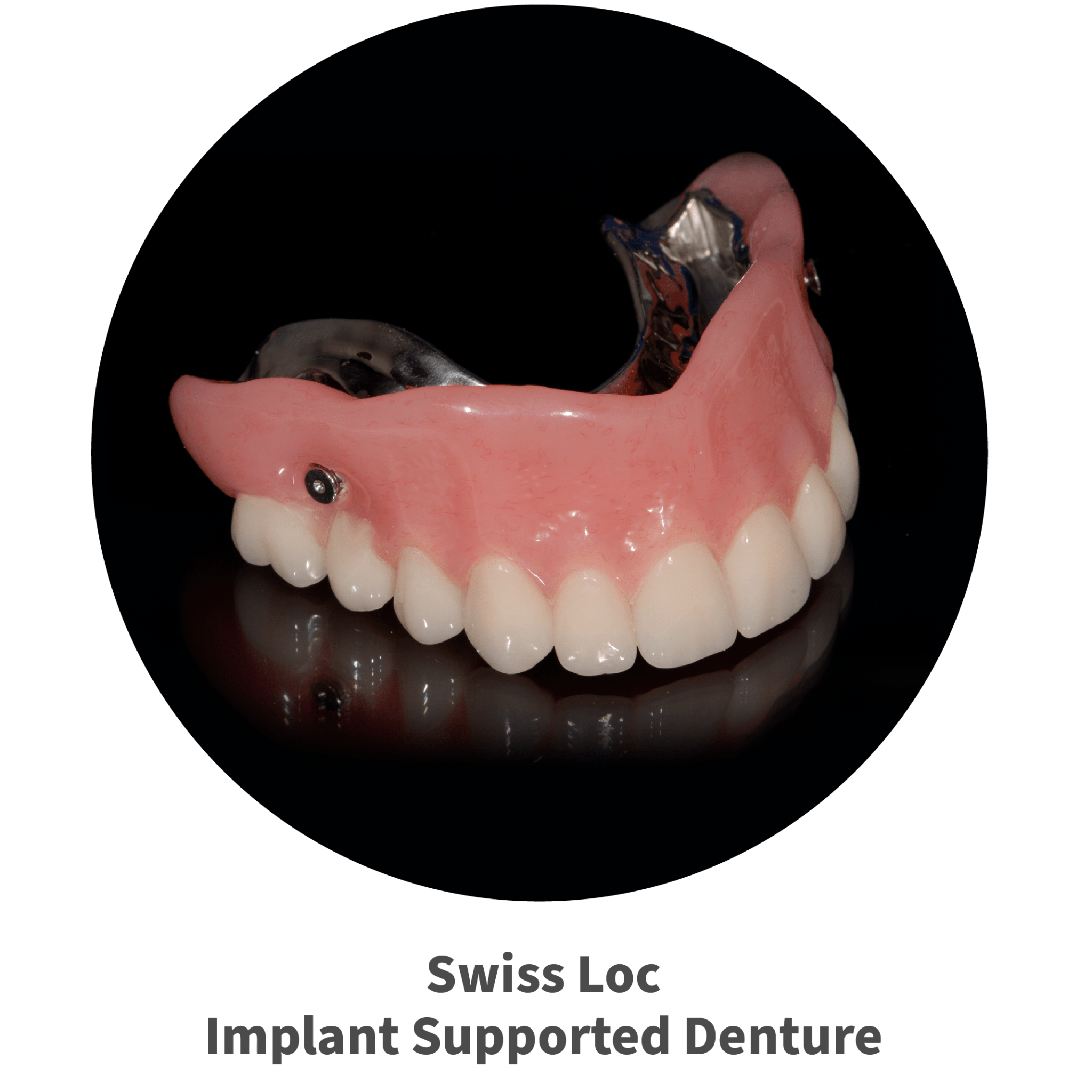 Dental Labs in Arizona Removable and Implant Supported Denture