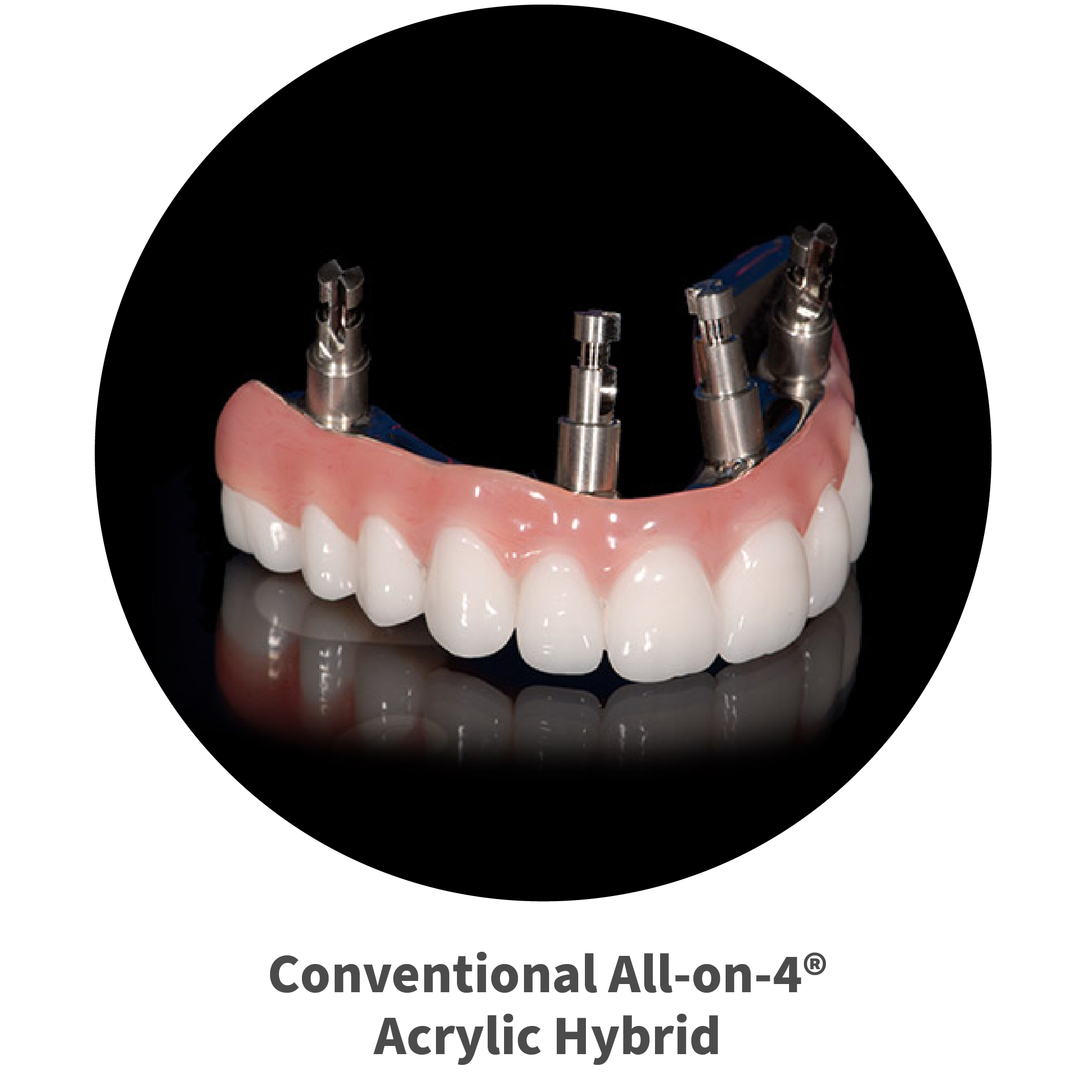 Dental Labs in Arizona Removable and Implant Supported Denture