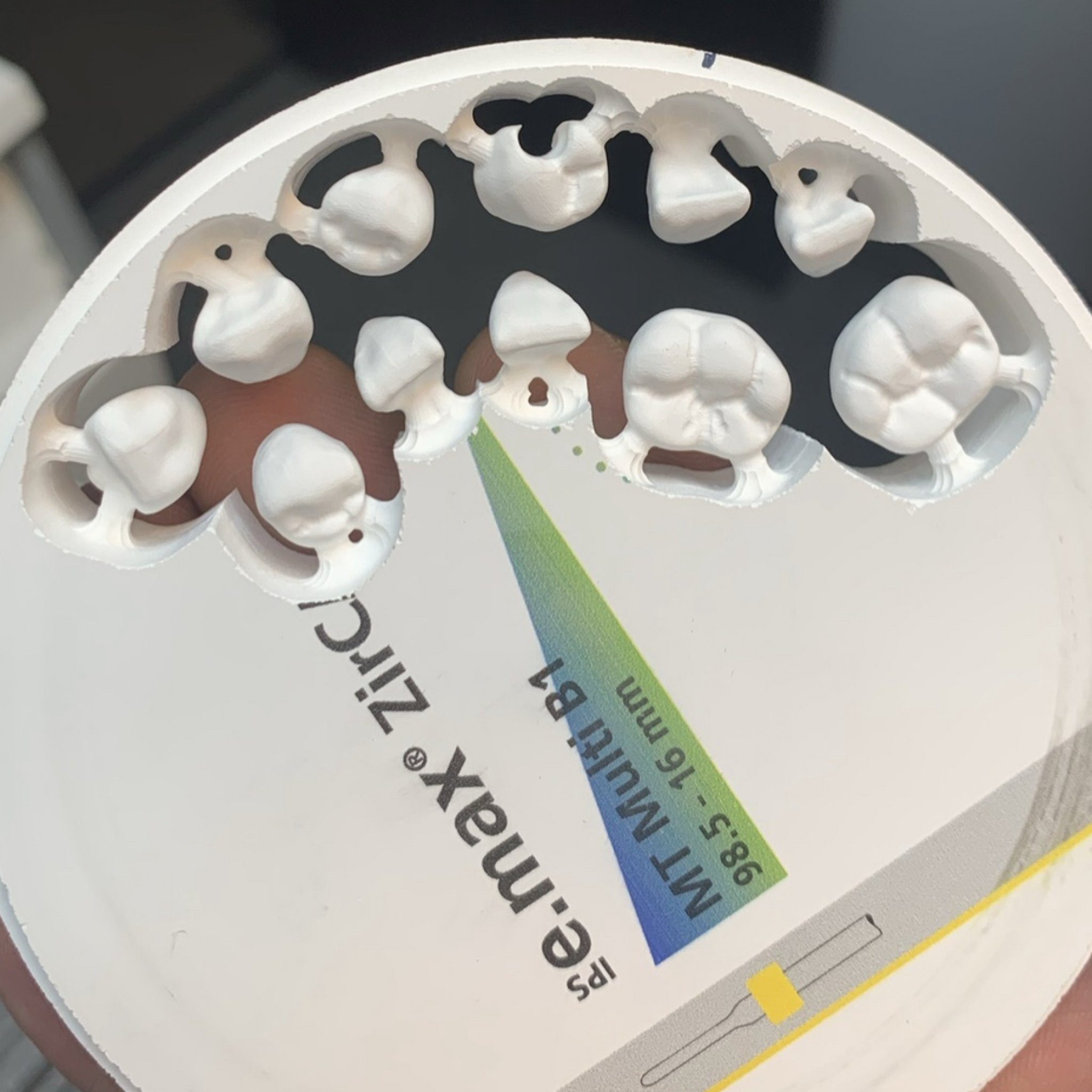 Dental Labs for Dentures in Arizona Conventional Full and Partial