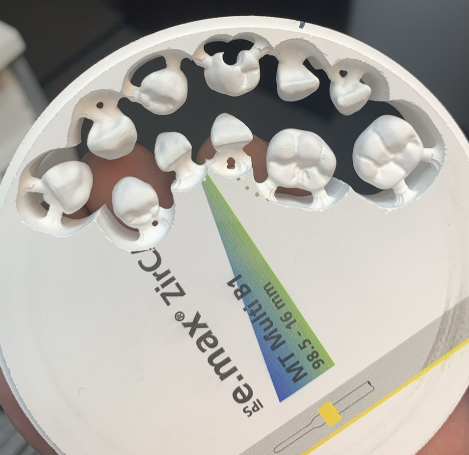 Dental Labs for Dentures in Arizona Conventional Full and Partial Dentures