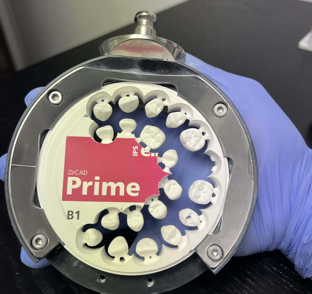 Dental Labs for Dentures in Arizona Conventional Full and Partial