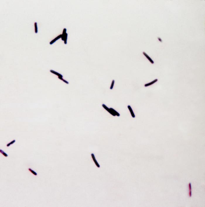 Clostridium difficile infection laboratory findings wikidoc