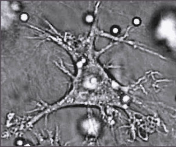 Dendritic cell wikidoc