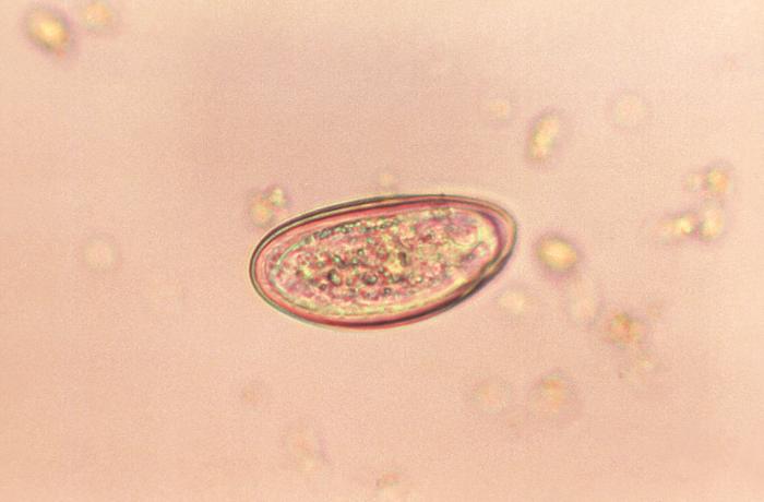 Pinworm wikidoc