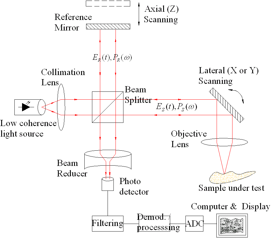 Optical coherence tomography wikidoc
