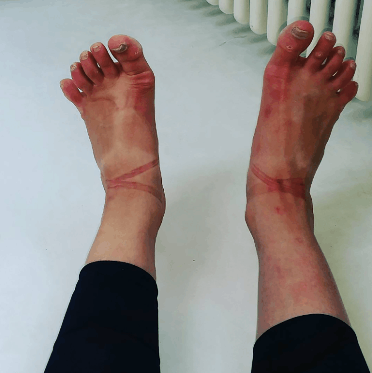 Ballerina Feet Pictures that will Haunt you for Rest of Your Life 50